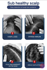 Load image into Gallery viewer, Intelligent Detection Scalp Therapy Device